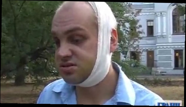 Видеоклип Игорь Ясин о своем избиении 