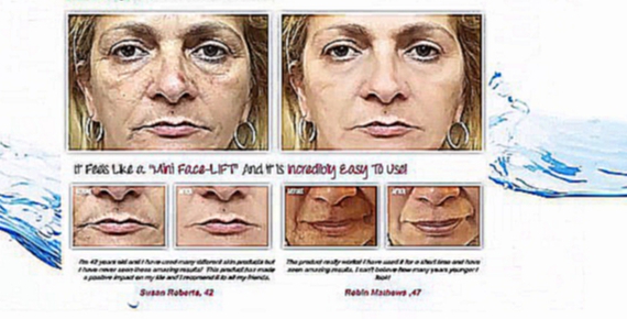 Видеоклип La Lumieres Facial Brightener Review - Younger Looking Skin Minus The Botox